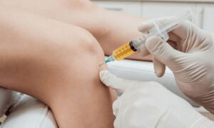 As An Athlete, Should I Consider PRP Injections? post